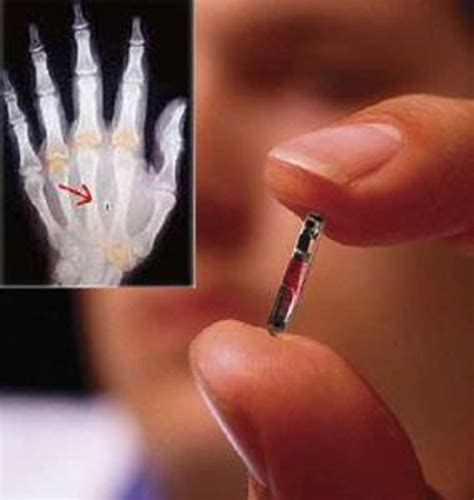 countries against rfid chipping|Personal chips get under your skin .